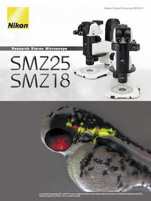 https://auroscience.hu/wp-content/uploads/2019/07/bros-nikon-smz25-sztereo-mikroszkop.jpg